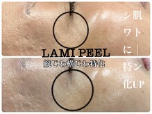 アイリー(IRIE)の雰囲気（県内初☆大人のピーリング☆何度も鏡を見たくなる◎）