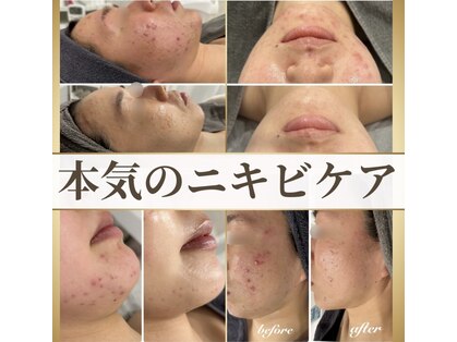 ビューティーブルーム(BeautyBloom)の写真