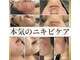 ビューティーブルーム(BeautyBloom)の写真