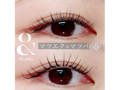 デイジー(Daisy)の写真