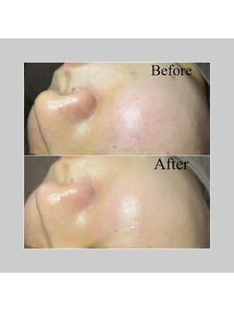 ブラックボックス(BLACK BOX)/20代女性のお客様