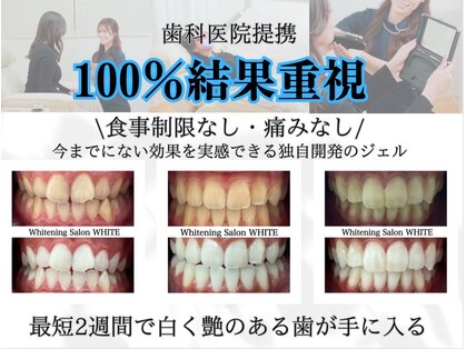 ホワイトニングサロン ホワイト 前橋店(WHITE)の写真
