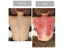 チョアチョア 札幌すすきの店(CHOA-CHOA)の雰囲気(カッサで老廃物排出促進!スッキリさがやみつきになります!)