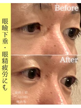 ココロ(COCORO)/目元がスッキリ!眼精疲労にも