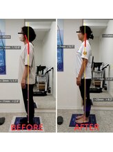 きっと整体院/首・肩の変化