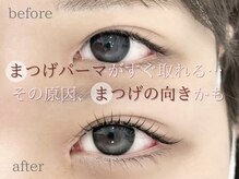 アイラッシュサロン ウインクル(Eyelash Salon Winkle)/下がりまつ毛のあなたへ