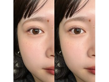 シーン(SCENE)/まつげパーマ