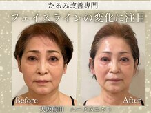 ドクターボディクリスタル(Dr.Body Crystal)