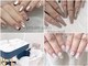 リノネイル(Rino-nail)の写真