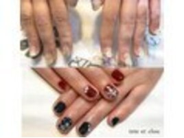 ジェルスカルプによる育爪形成