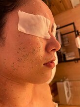 凪 横浜/クレイの力で肌内外デトックス