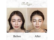 ベルガ 恵比寿店(Bellega)/ヘッドスパ小顔矯正