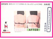 フレクシー/４D　beforeafter