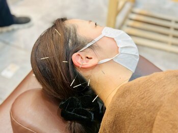 はぴねす鍼灸整骨院 天六院