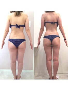 リラパドマ 千葉店(Rela Padma)/激痩せ短期集中ダイエットコース