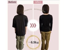 えのもと美容整体院/20代女性