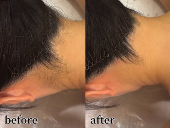 リーインカーナ アーティスト(REINCARNA ARTIST)/襟足脱毛【襟足美人】