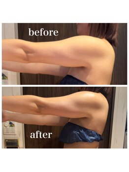 リフリコ/韓国発の脂肪分解レモンボトル