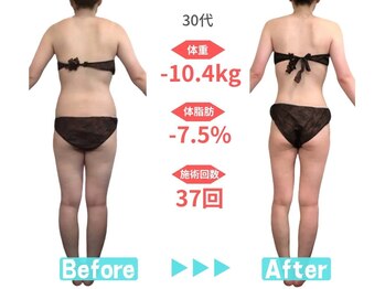 ビースタイル 多治見店(B'style)/30代マイナス10キロ