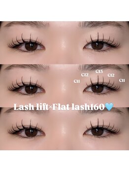 リンネ(LinNe)/KURUMI担当