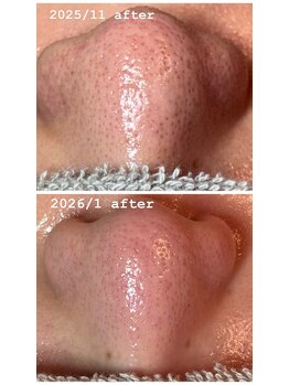 レンリー(Renry)/3ヶ月でここまで変わる！！