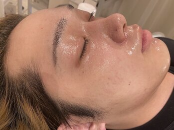 ベル(belle)の写真/【次世代型韓国肌管理プログラム】透明感＆清潔感UP☆キレイな肌の男がモテる時代！憧れツル肌に☆