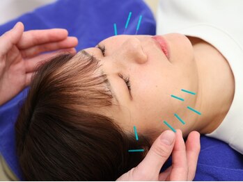 A.T.長島治療院 北浜院の写真/20代~50代に人気!鍼灸×マッサージで全身の不調を根本改善。美容鍼×パックで理想の小顔とスッキリ感も◎