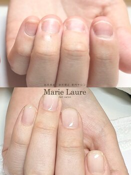 マリーロール 梅田店(Marie Laure)/自爪育成/深爪矯正/ネイルケア