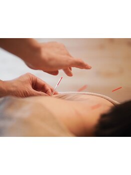 鍼灸施術を受けたい