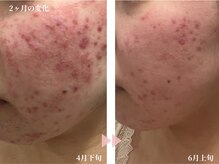 レスイズモア 恵比寿(less is more.)/２ヶ月の変化、食事改善！