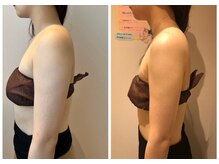 エイシスグロウ(asis glow.)/効果写真