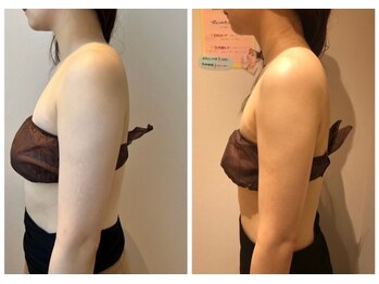 エイシスグロウ(asis glow.)/効果写真