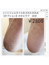 ネイル フライガール(nail FLY GIRL)/かかとケア