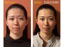 ロイヤリティ(ROYALTY)の雰囲気（【医療提携サロン◆完全個室貸切】自分磨きに集中する特別な時間）
