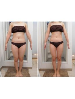 エステ ド マシェリ―/身体の不調を整えながら健康美へ