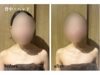 オトサロン(Otosalon)/肩の盛り上がり気になりますか？