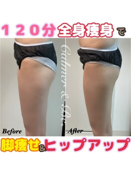 カルマーアンドビー(Calmer & Be.)/【レディース痩身】Before/After