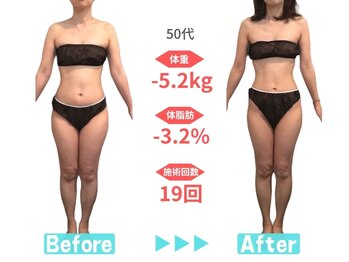 ビースタイル 多治見店(B'style)/40代マイナス4キロ