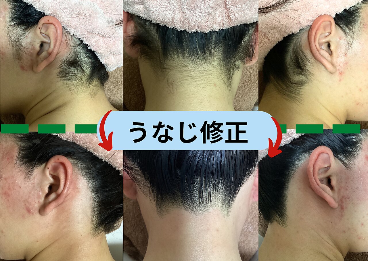 ディスイズミー シュガーリング(This is me Sugaring)｜ホットペッパー