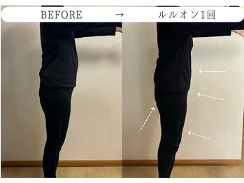 ヨサパーク ノワール(YOSA PARK Noir)/ルルオン1回