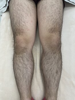 エリクサー 熊谷店(Elixir)/剛毛大歓迎◎