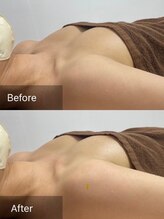 エーアイビューティー 御徒町店(Ai Beauty)/ 【バストアップ例】