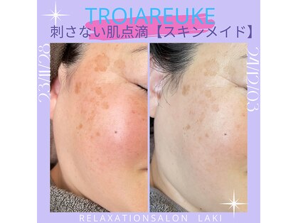 リラクゼーションサロン ラキ(laki)の写真