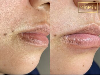 ルプラス(LUPLUS)/高濃度保湿成分配合wax!