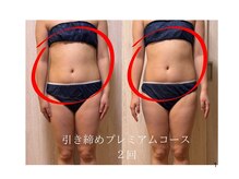 人気No.1引き締めコース！1回でウエスト、くびれ◎/痩身戸塚安行