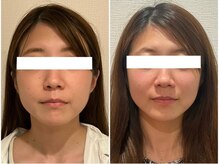 美容整体ウェリナ あま甚目寺院/小顔矯正/骨盤矯正/美脚サロン