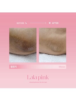 グラッソ(GRASSO)/ララピンク