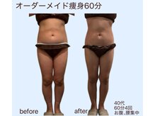 アリュールビューティー 下高井戸店(ALLURE BEAUTY)/モニター様紹介★