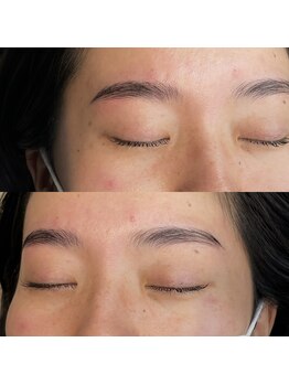 ネネ(nene.)/Hollywood brow lift