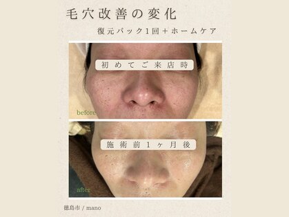 マノ(mano)の写真
